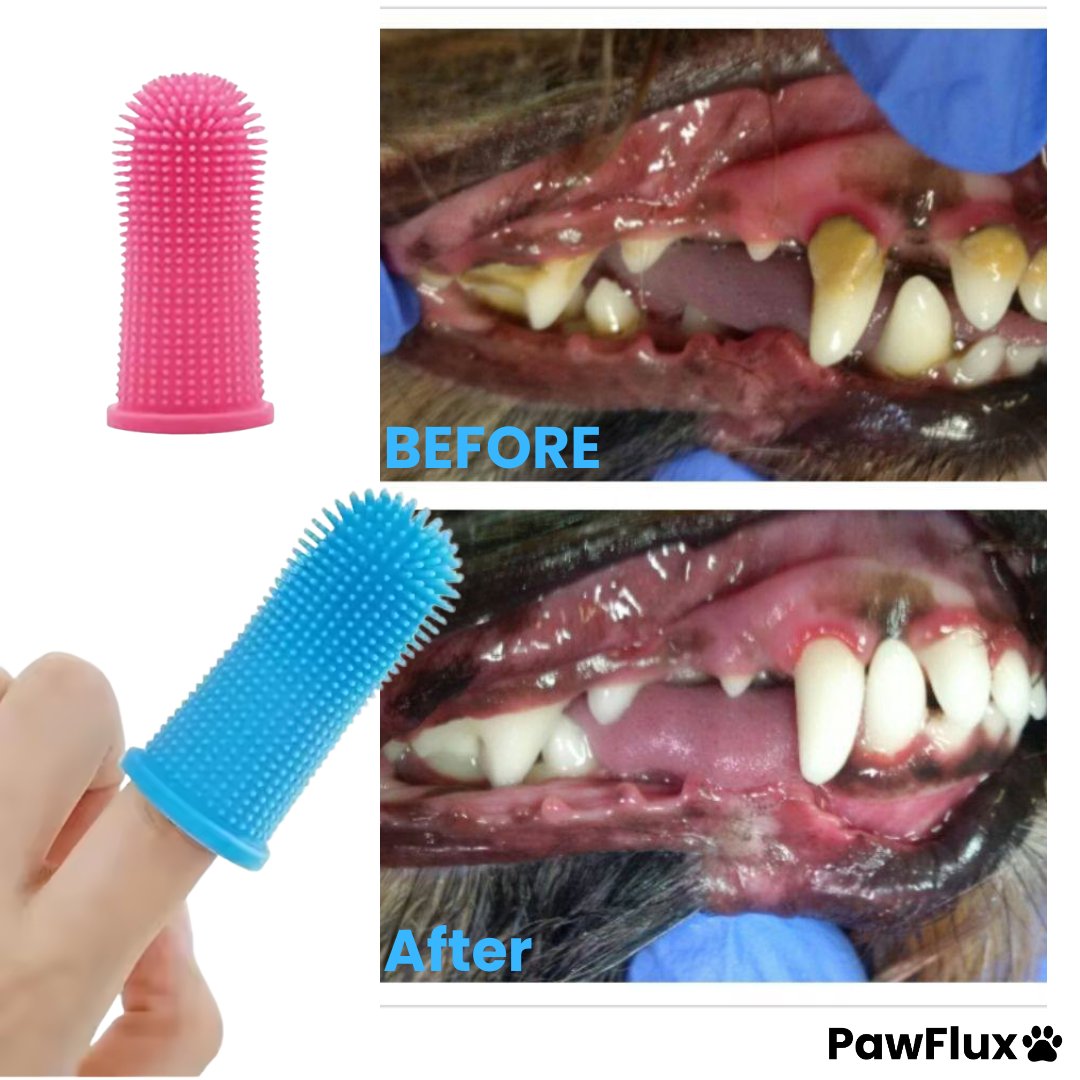 360° Finger Toothbrush